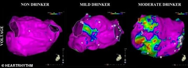 Scans showing the strength of electric signals