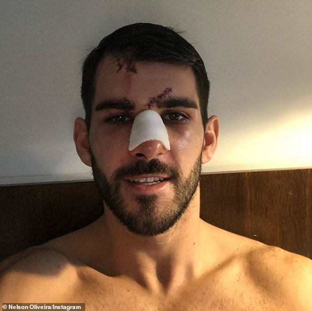 Nelson Oliveira thanked medical