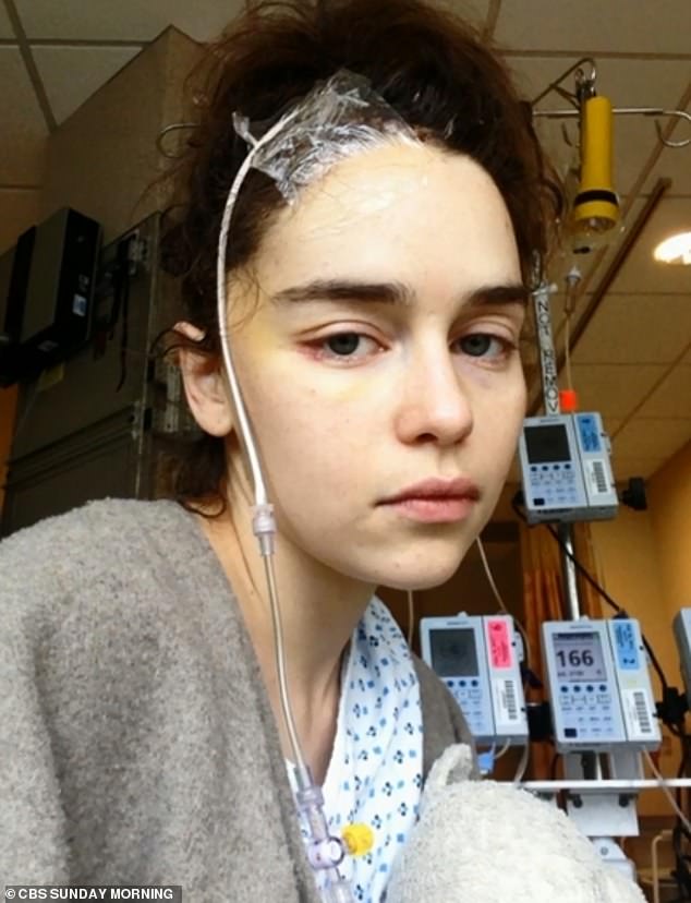 Shocking Emilia Clarke has released unseen photographs taken during her recovery from a life threatening brain aneurysm in 2011 when she was just 24 years old