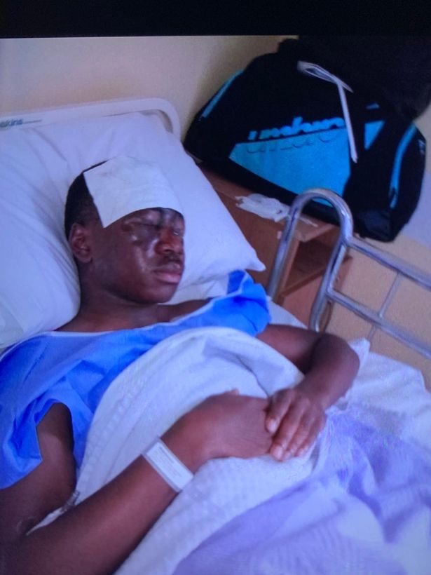 Upcoming footballer, Tega Agberhiere blinded in acid attack